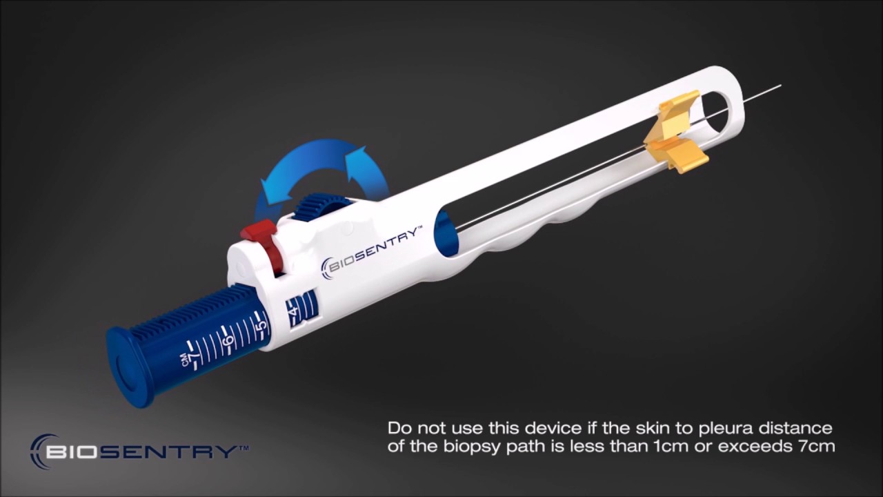 BioSentry&trade; tract sealant system