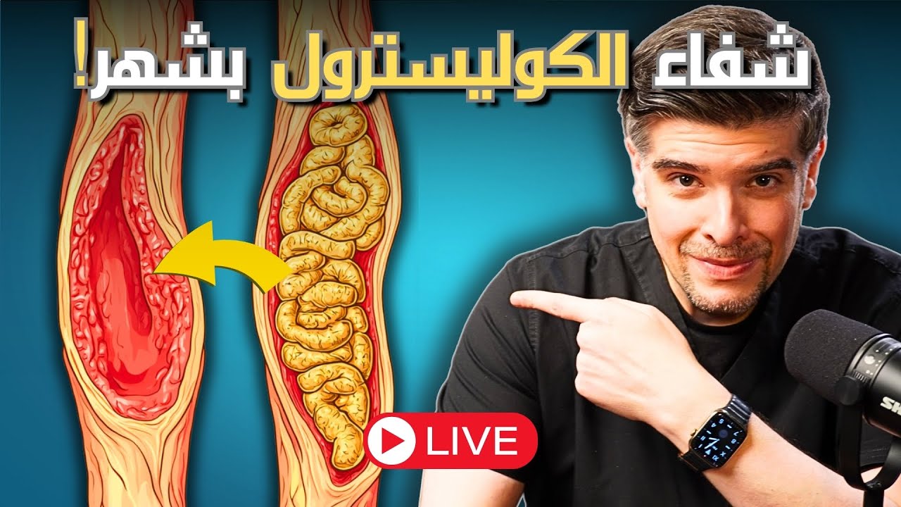 كيف تتخلص من الكوليسترول الضار بشهر (بلا دواء!) 