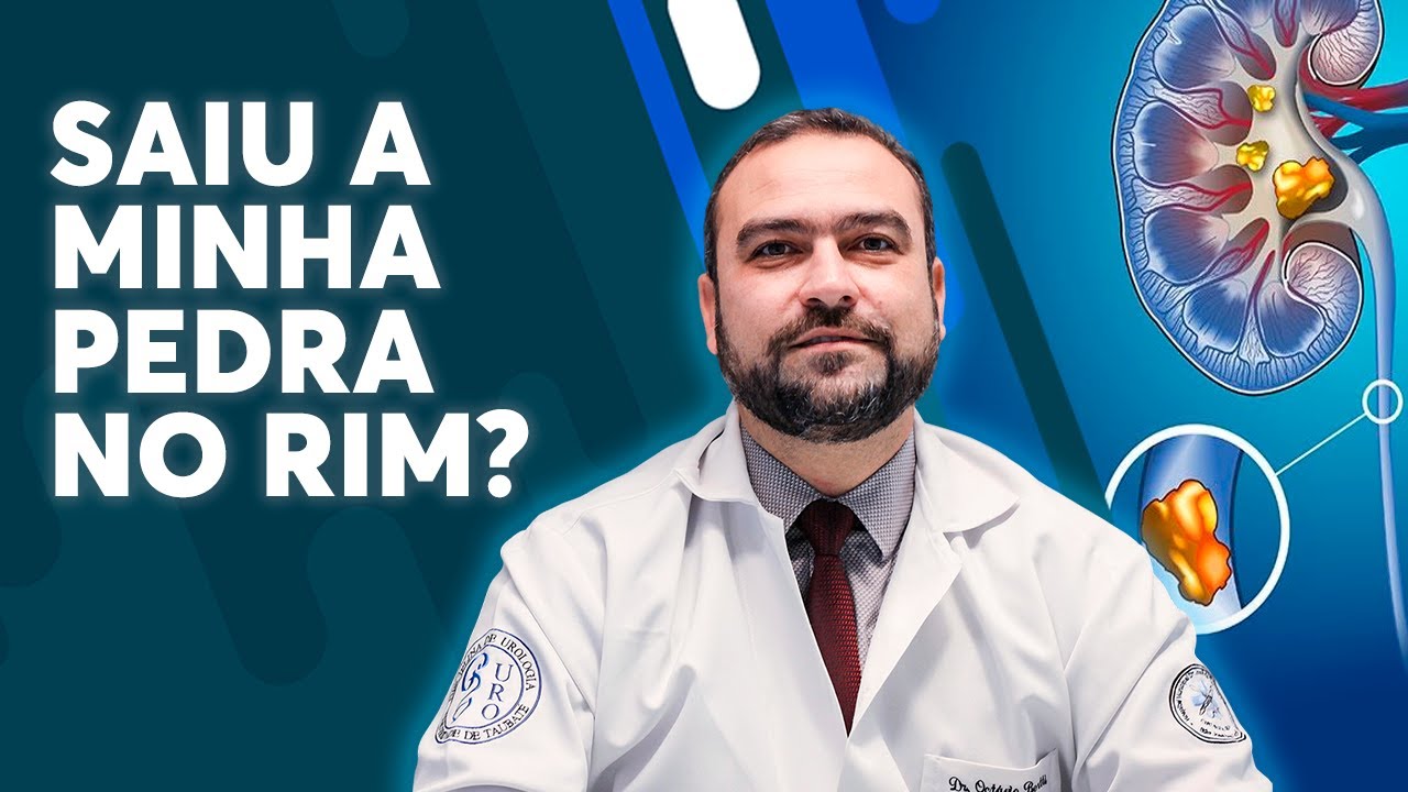 COMO SABER SE SAIU A MINHA PEDRA NO RIM?
