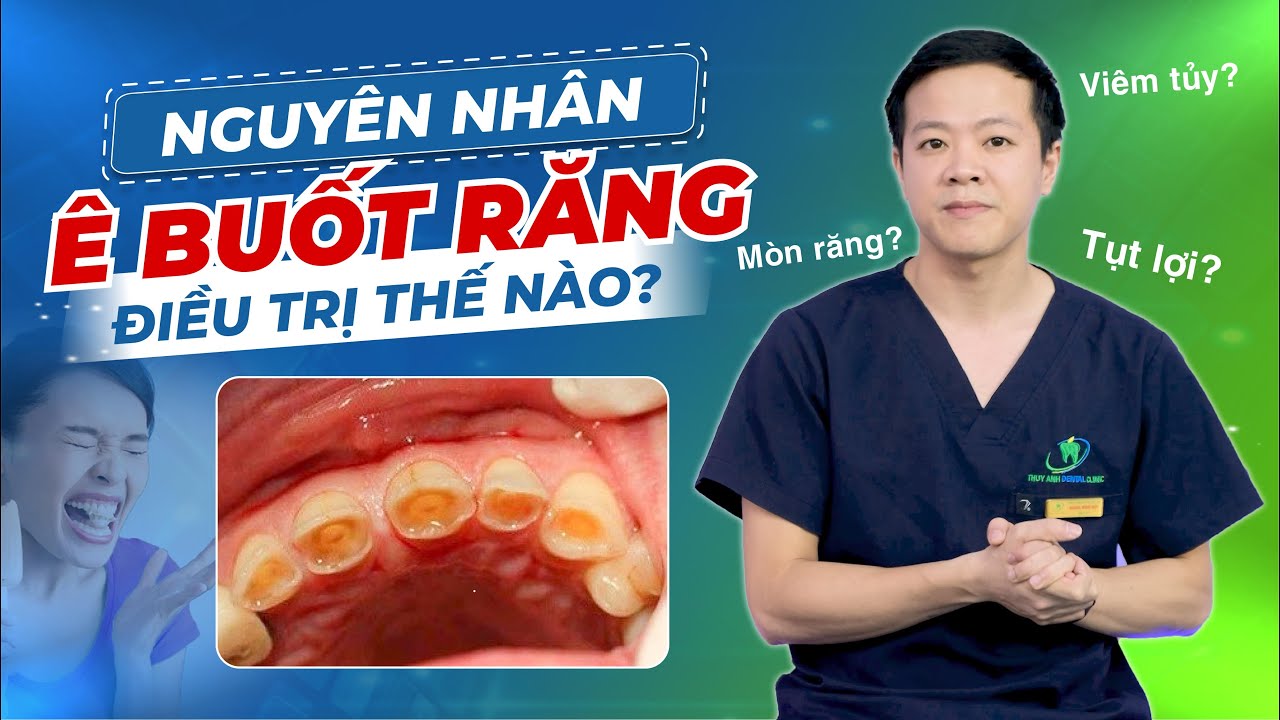 CÁCH CHỮA Ê BUỐT RĂNG - CÓ THỂ ÁP DỤNG NGAY TẠI NHÀ