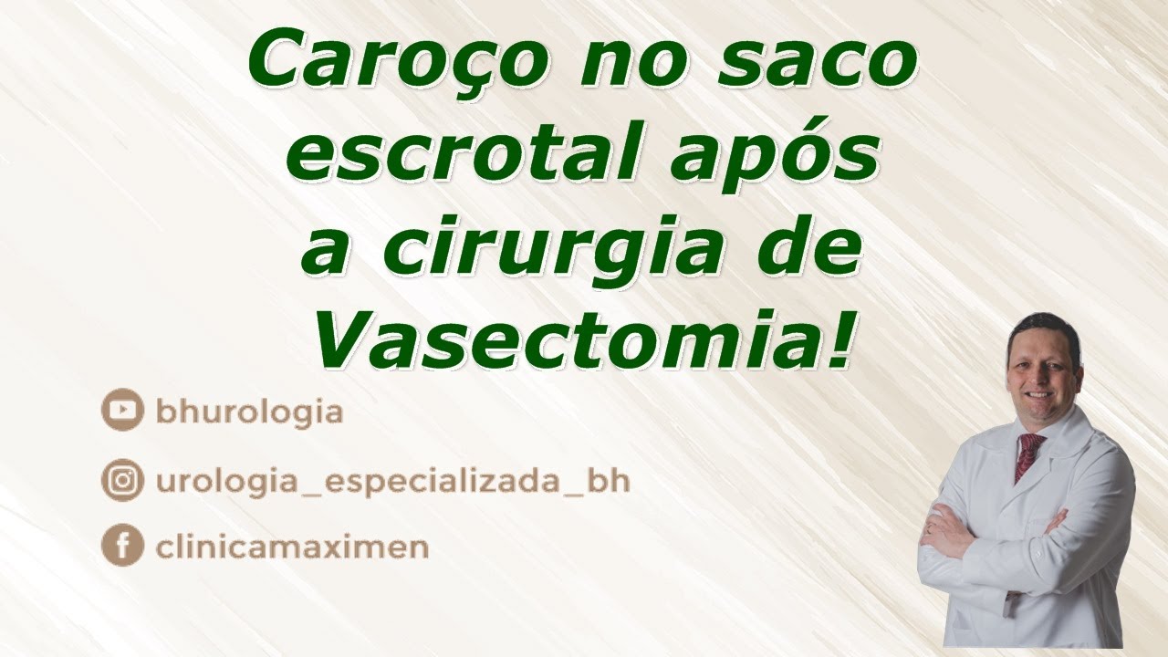 Caroço no saco escrotal após vasectomia