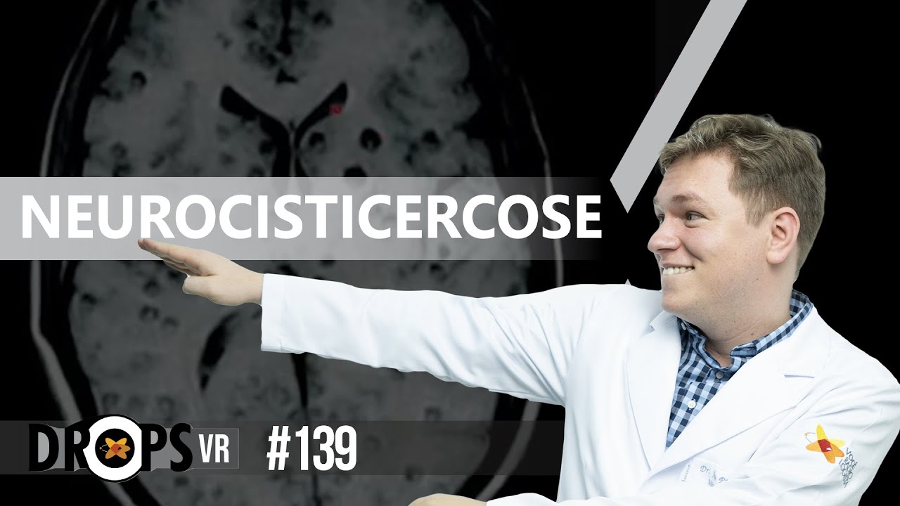 ACHADOS DE IMAGEM NA NEUROCISTICERCOSE