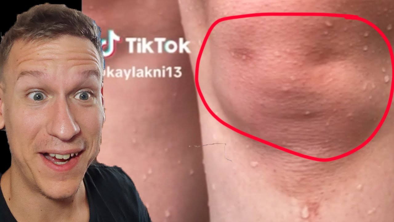 Zaradi TIK TOKA sm Postal Srečen