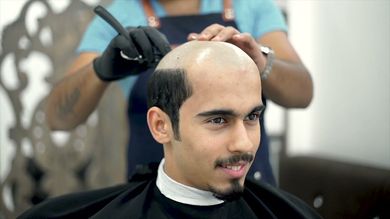 افضل طريقة لتركيب شعر رجالي #حسن_المهندس #hair_style