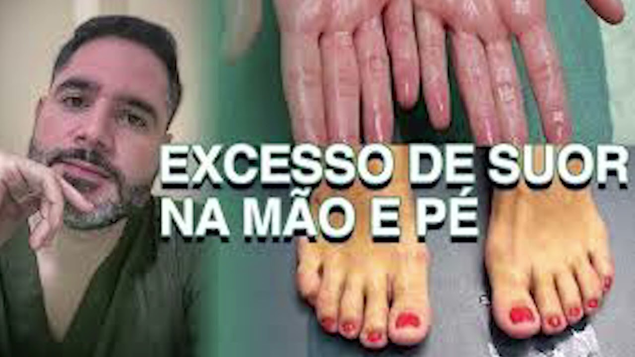 O que é sudorese nas mãos