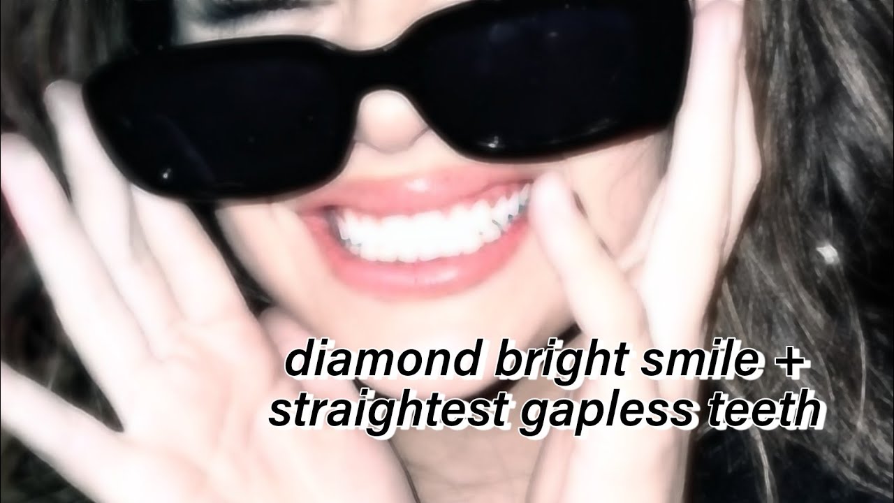✧･ﾟ:* 𝑺𝑯𝑰𝑵𝒀 𝑺𝑻𝑹𝑨𝑰𝑮𝑯𝑻 𝑻𝑬𝑬𝑻𝑯 + brightest stunning smile