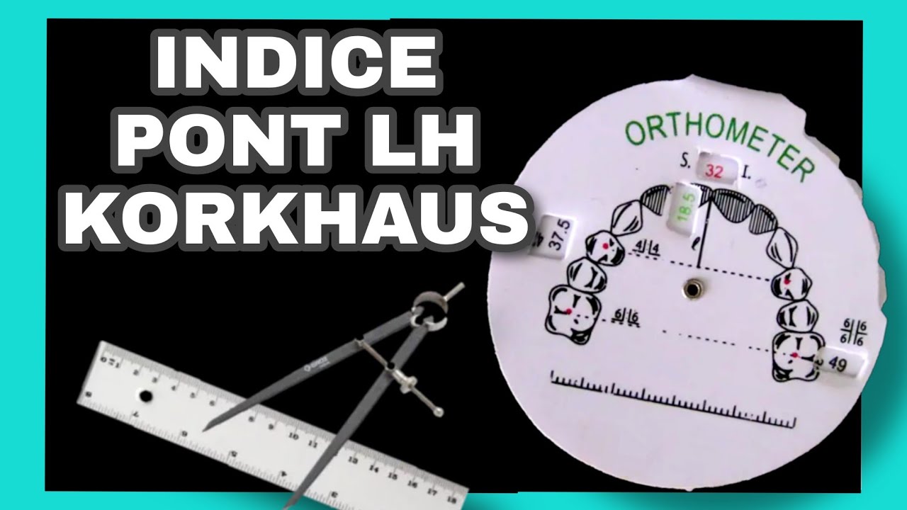 Indice de Pont LH Korkhaus