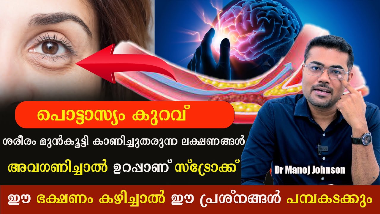 ശരീരത്തിൽ പൊട്ടാസ്യം കുറയുന്നതിന്റെ ലക്ഷണങ്ങൾ ?അവഗണിച്ചാൽ ഉറപ്പാണ് സ്ട്രോക്ക് /Dr ManojJohnson