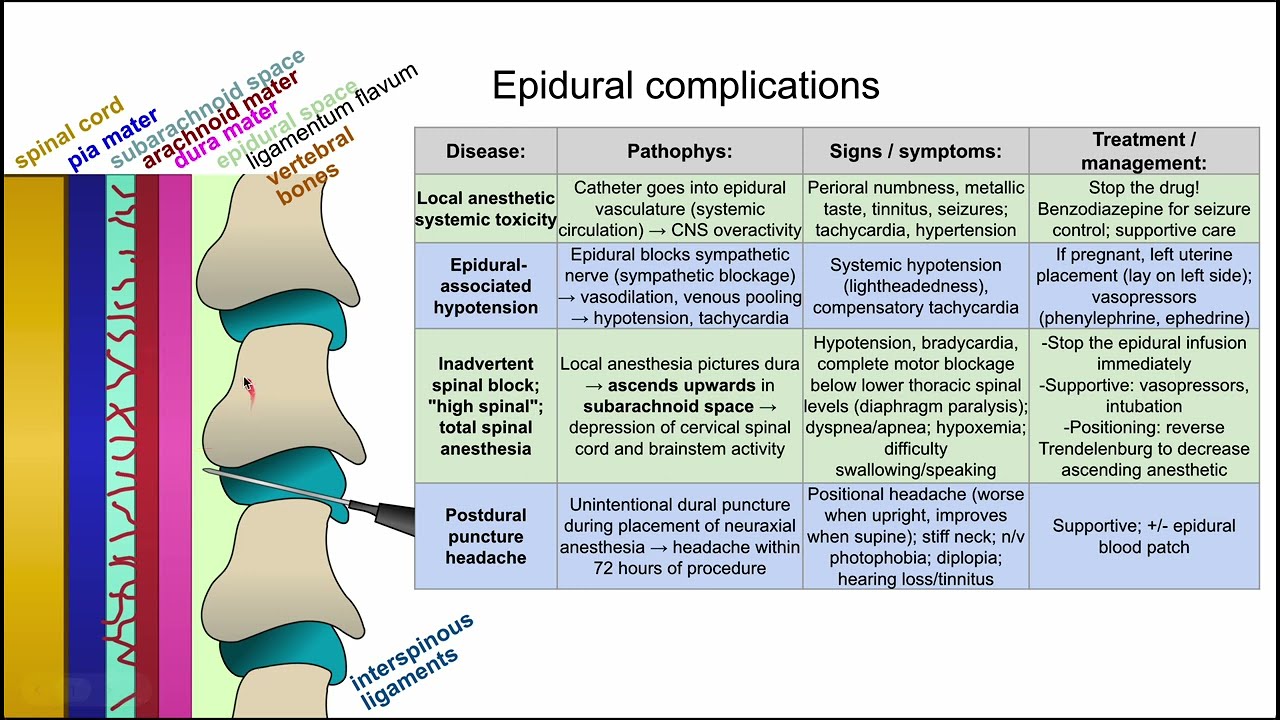 Epidural anesthesia complications