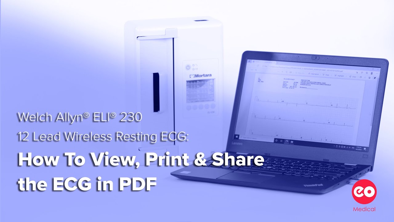 Welch Allyn Mortara ELI 230 Wireless ECG: How To View, Print & Share the ECG in PDF