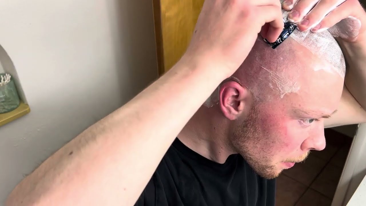 Bald Experience: Hairiest Bald Guy