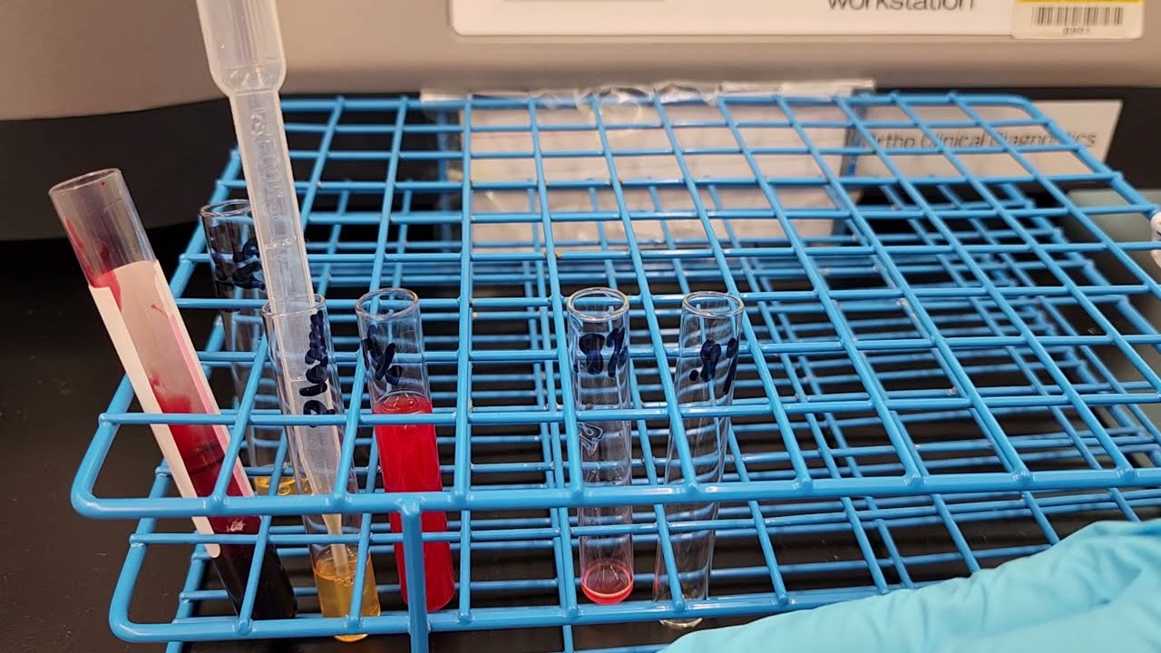 Blood Banking: How to Make a 0.8% Red Cell Supspension