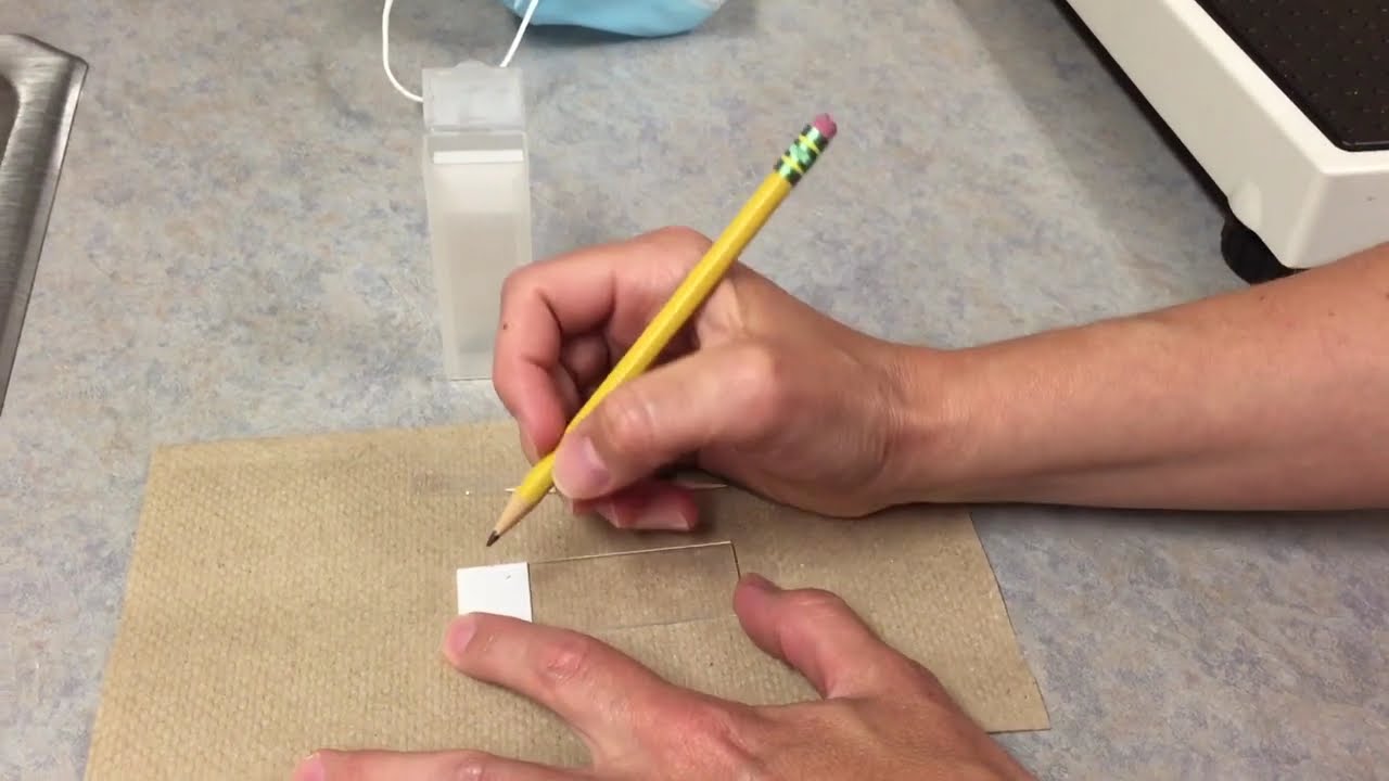How to collect a cheek cell smear