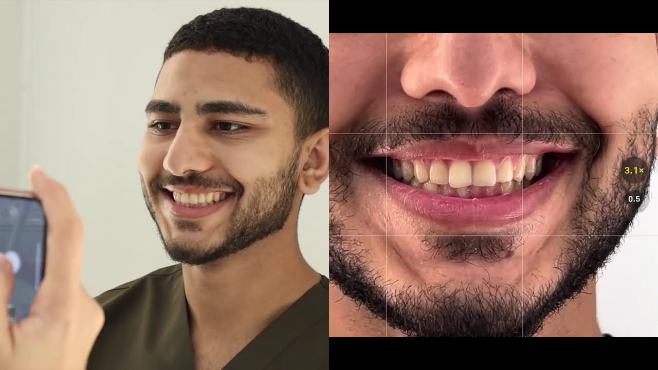 Дентальная фотография стала проще