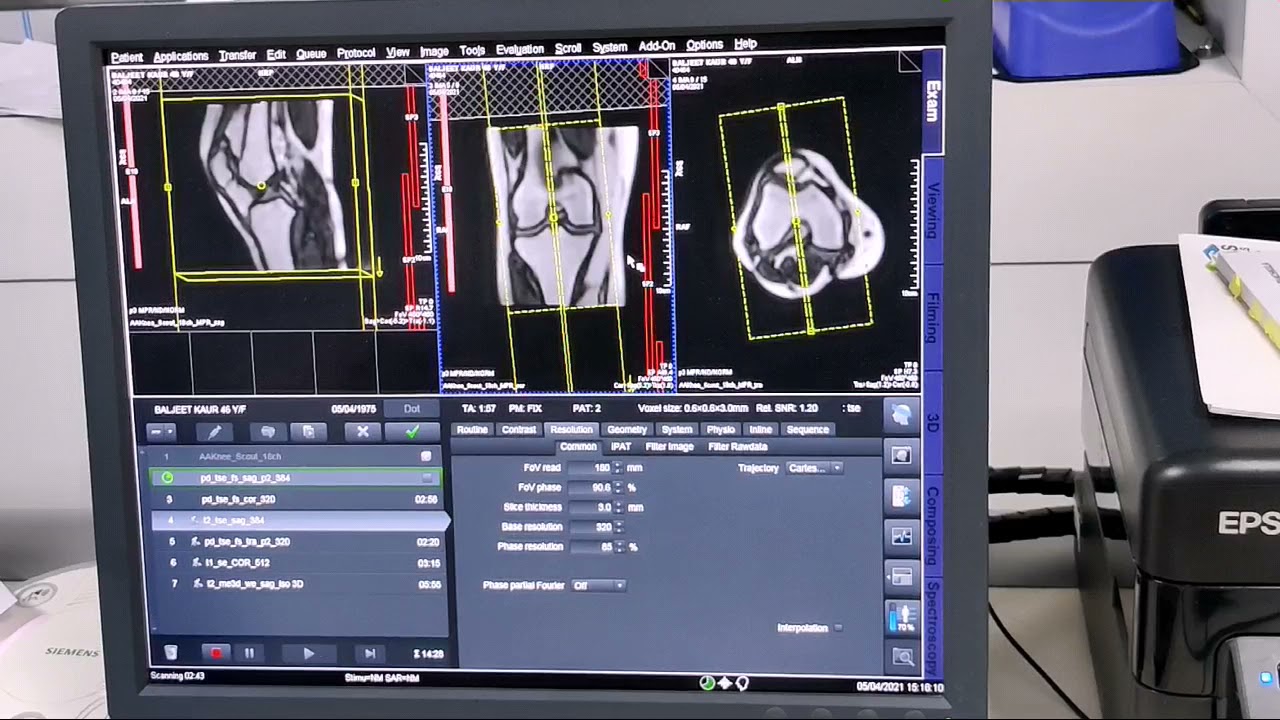 #MRI