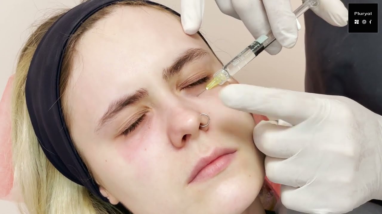 Dark Circles treatment with Pluryal Silk
