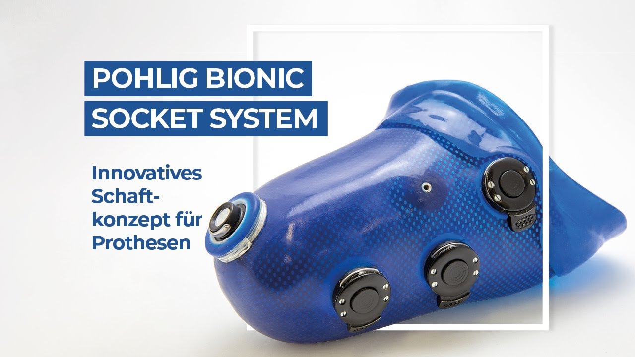 Pohlig Bionic Socket System (PBSS) | Innovatives Schaftkonzept für Oberschenkelprothesen