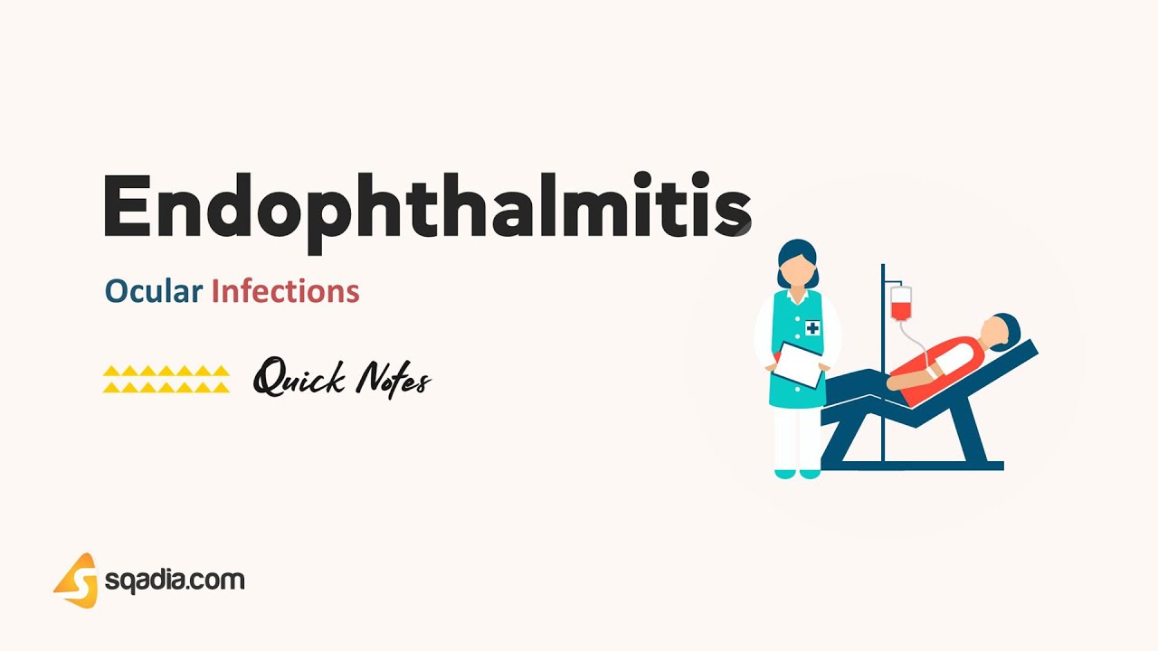 Ocular Infections | Endophthalmitis