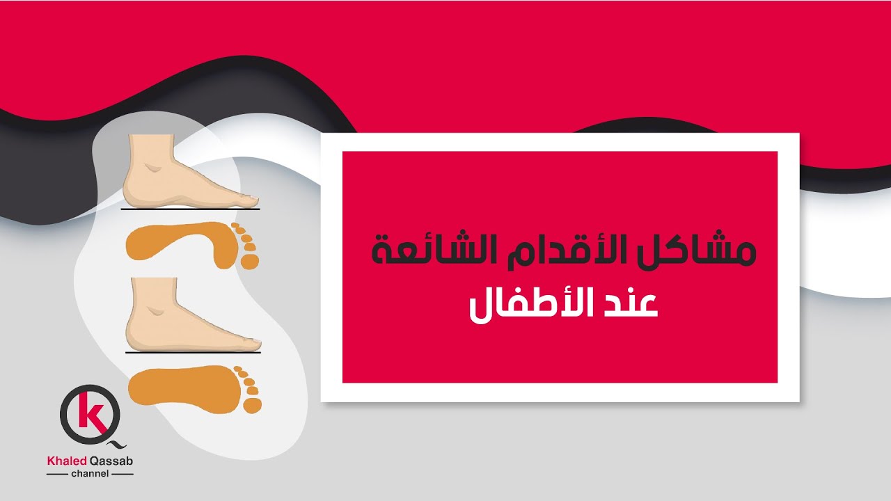 مشاكل الأقدام الشائعة عند الأطفال
