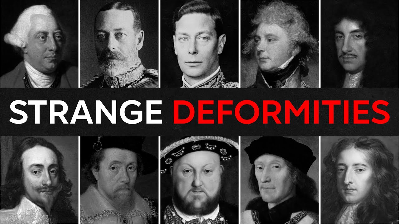 25 BRITISH Kings and Queens With SECRET Disabilities And Deformities | For Sleep
