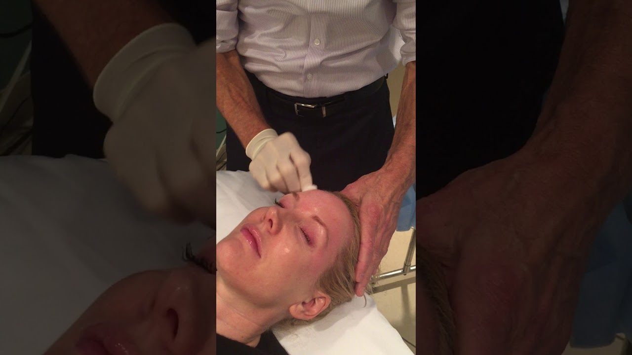 Trichloroacetic Acid (TCA) Chemical Peel - Procedure (what to expect) Columbus Ohio