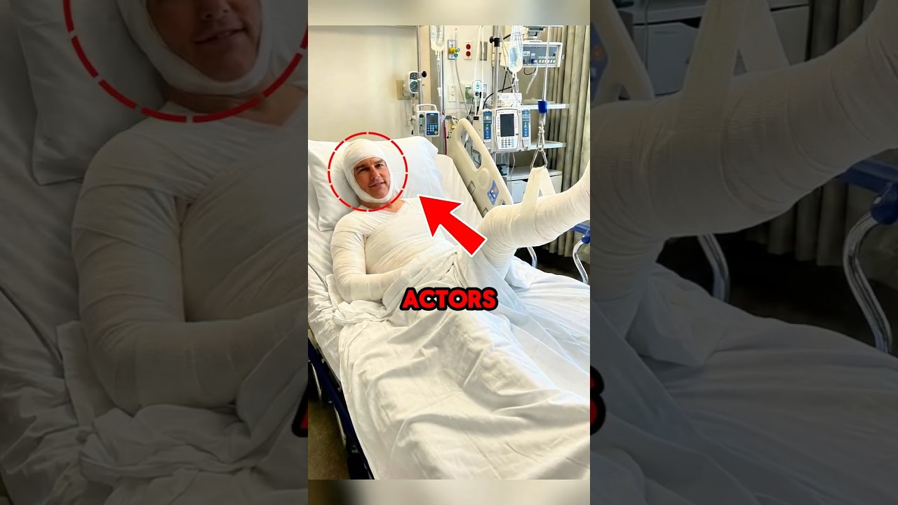 3 Actors Who Got Injured While Filming!😯