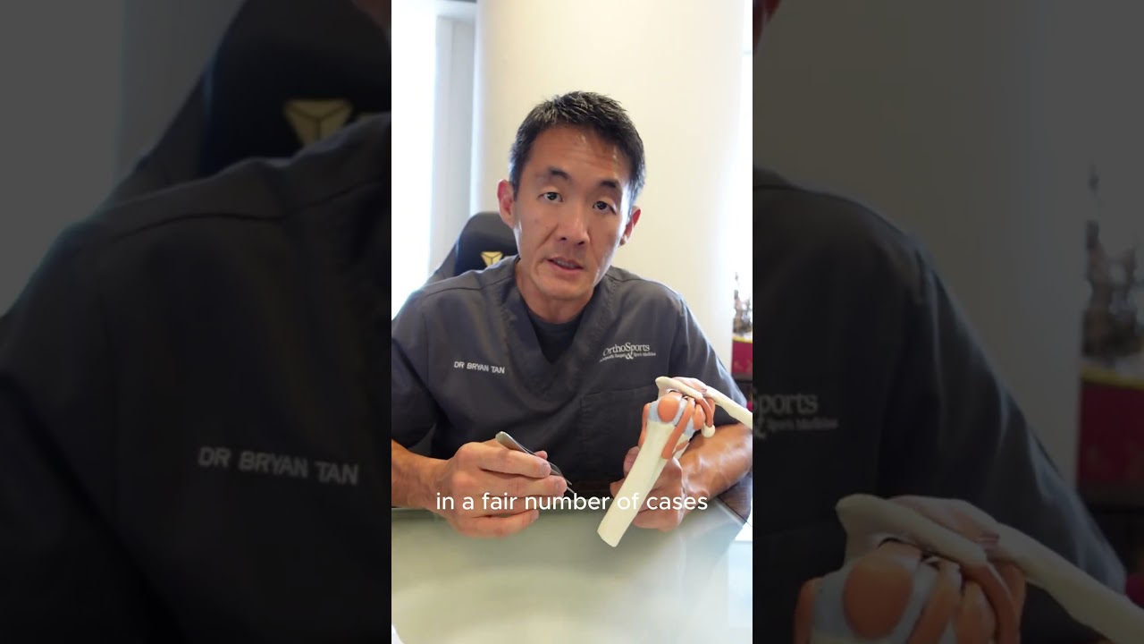 AC Joint Dislocation Surgery Explained | Sports Injury Insights
