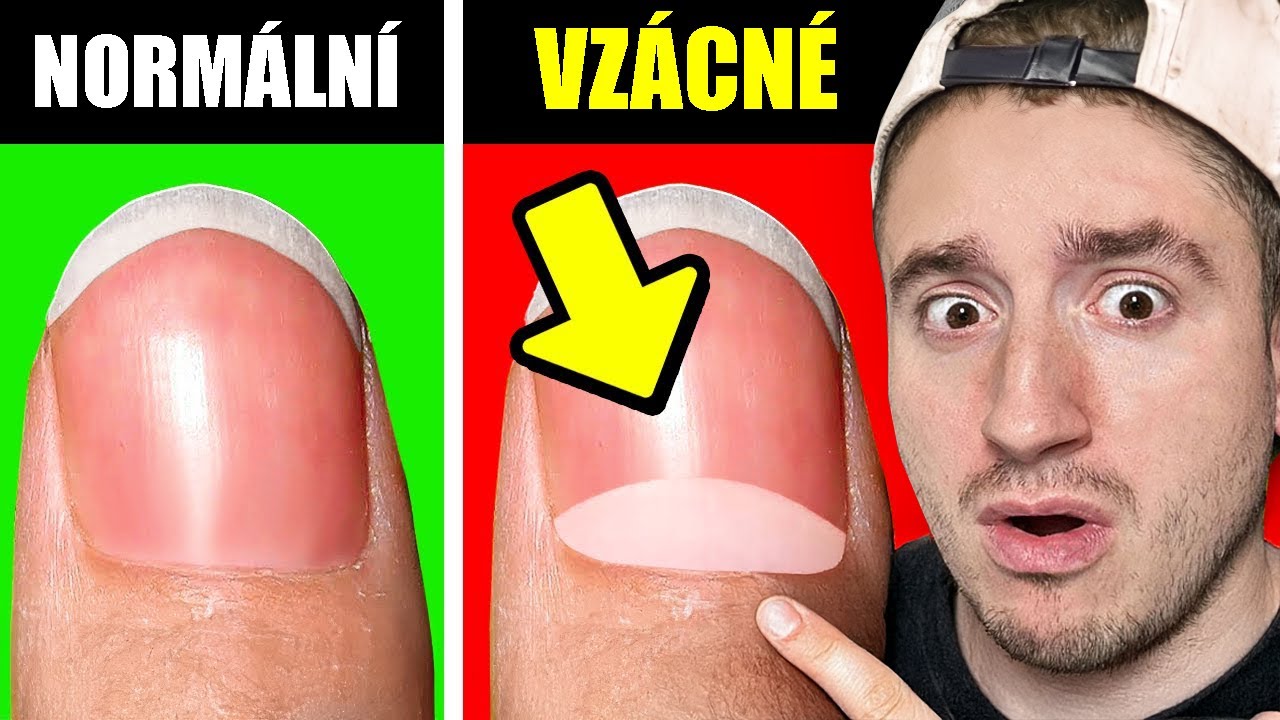 Jak vzácný jsi? Tohle ti to odhalí!