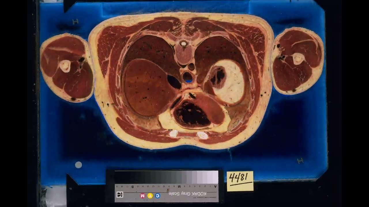 Visible Human Project Male video UHD/Виртуальная анатомическая модель тела человека - 20 кадров/с