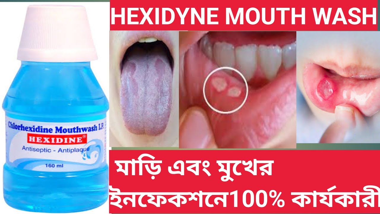 Hexidine | Hexidine Mouth Wash Use Dose Benefits Side effects In Bengali