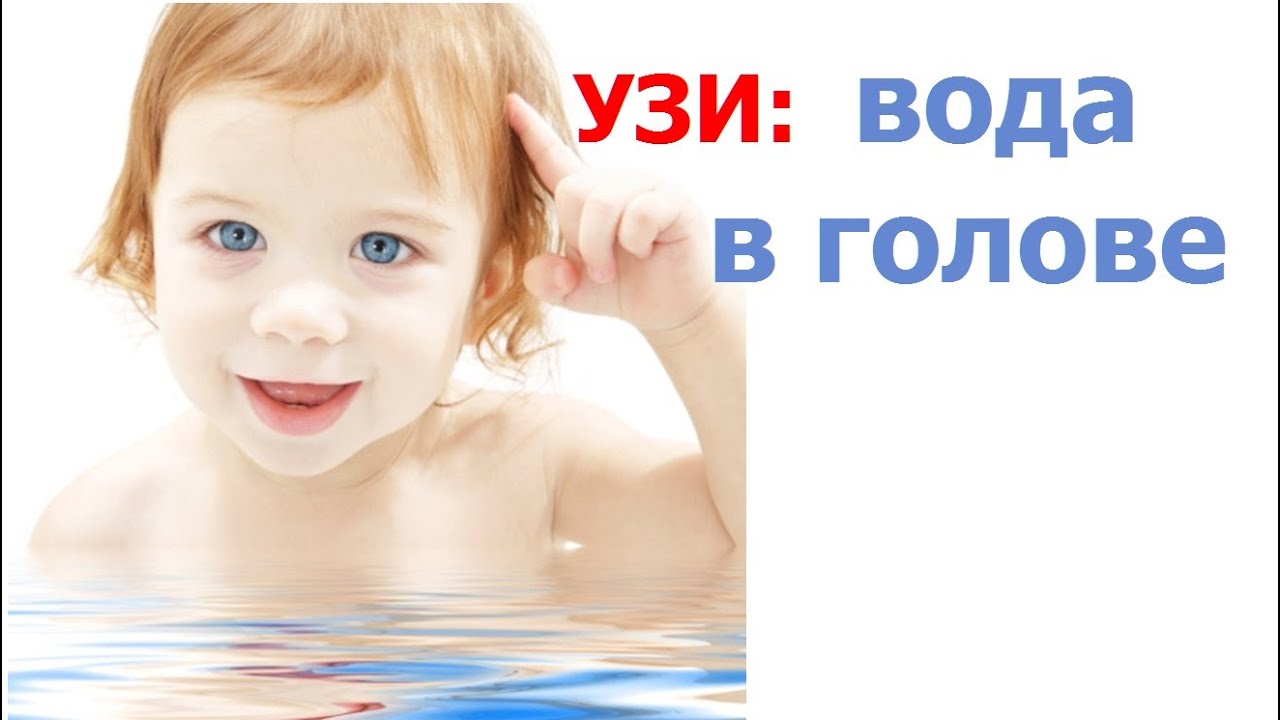 Вода (жидкость) в голове. Как расшифровать УЗИ  и  что делать