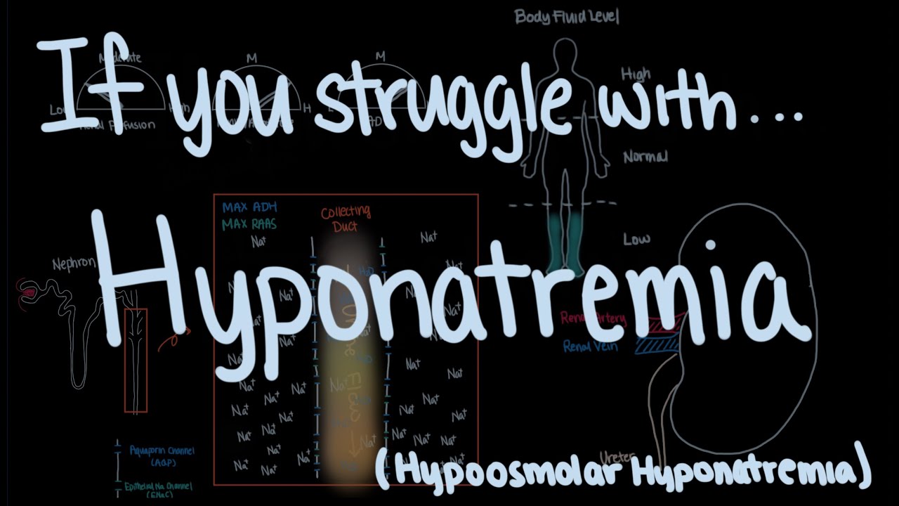 Pathophysiology of Hyponatremia