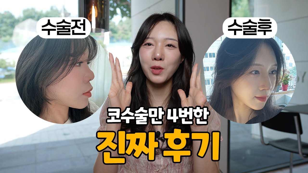 [100% 리얼 코 수술 후기] 4번의 재수술 드디어 되찾은 내 얼굴, 구축코 재수술 인생을 되찾다