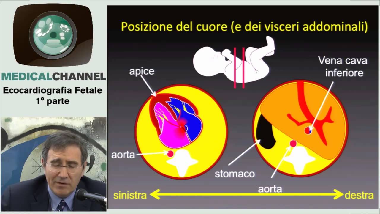 Ecocardiografia Fetale 1 - Corso Avanzato Esclusiva