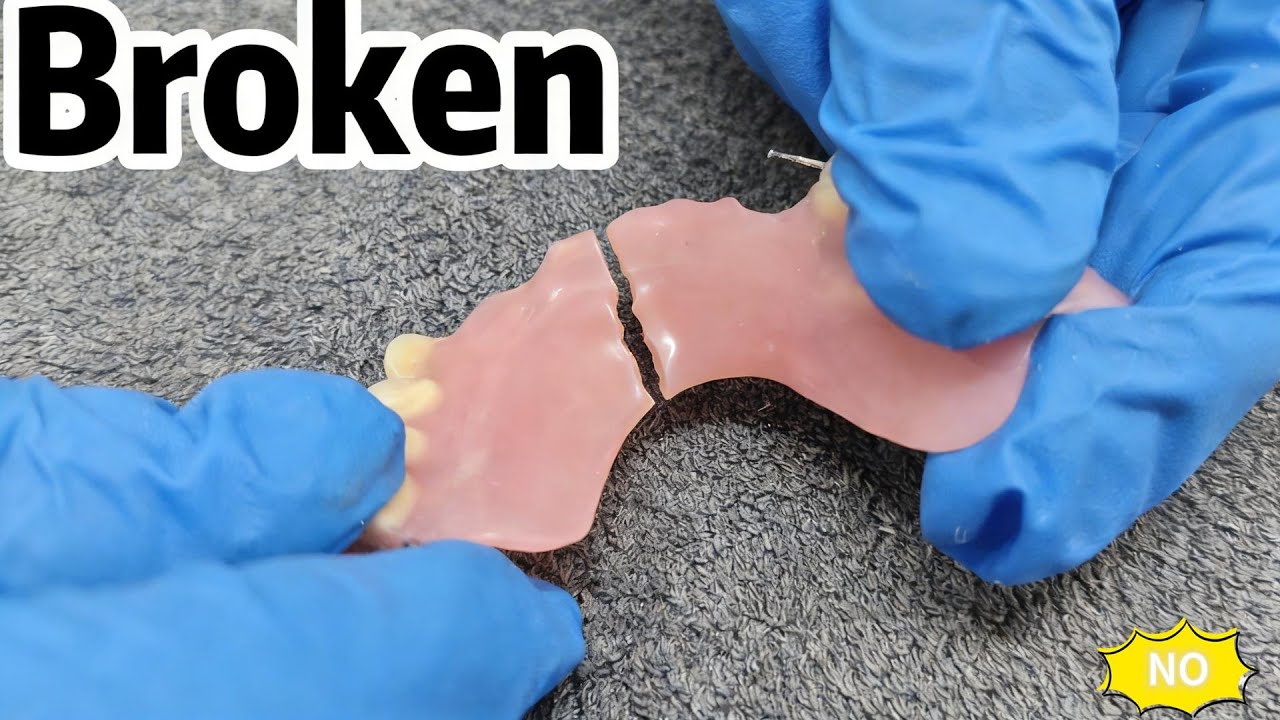 Mind-blowing results#dentalrestoration #satisfying #dentist