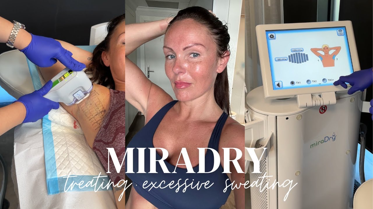Say Goodbye to Sweat: Miradry Treatment for Lasting Sweat Reduction!