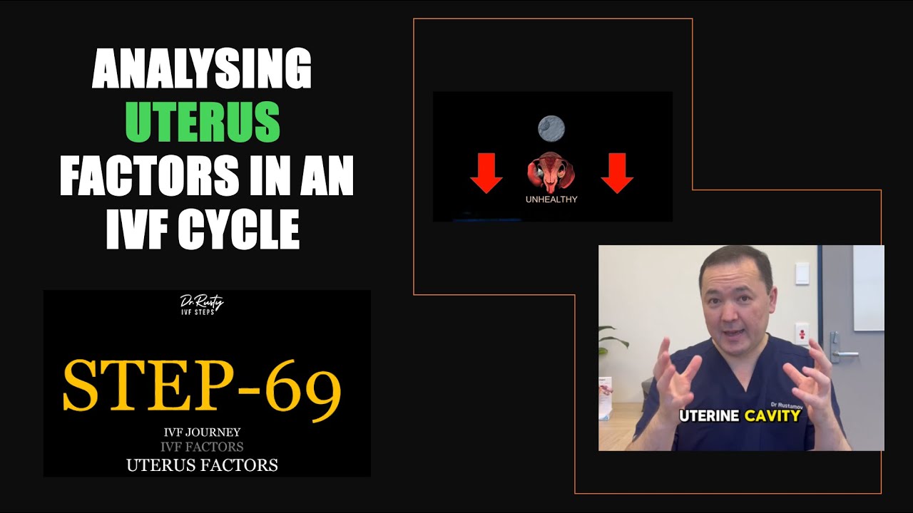 Analysing Uterus Factors in a failed IVF Cycle?! IVF 77 Steps: Step 69 - Uterus Factors #uterus #ivf