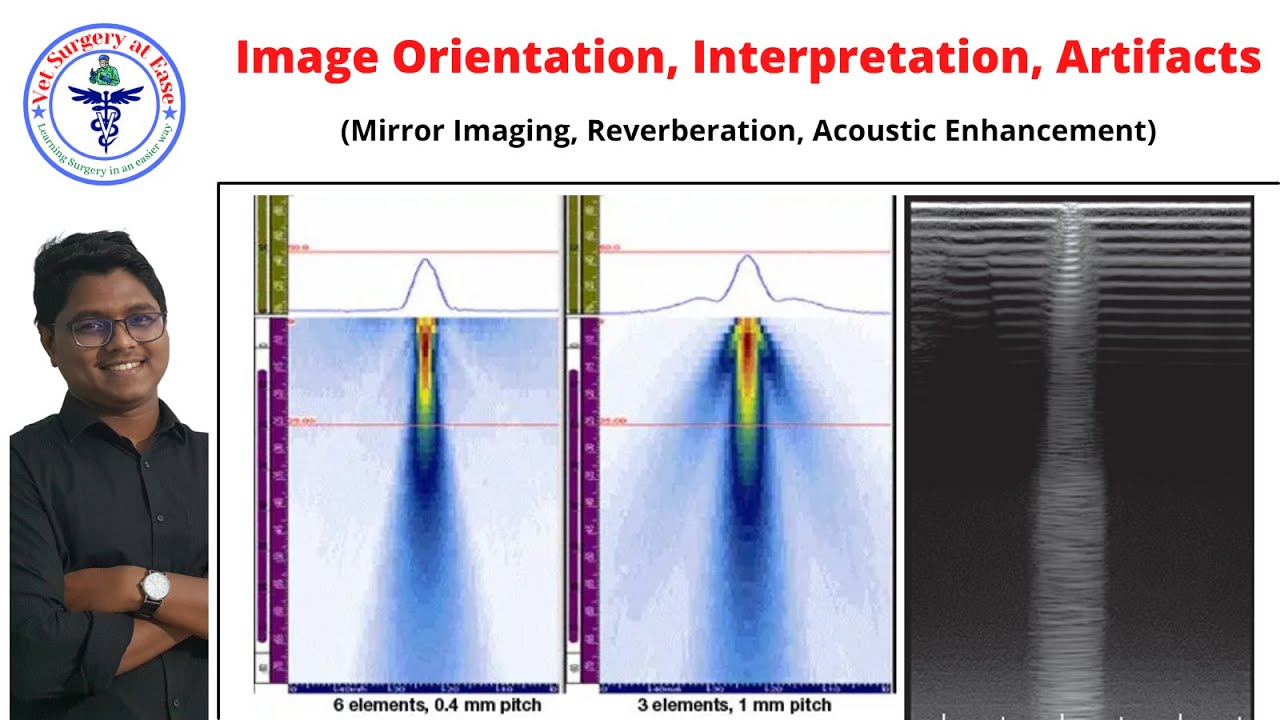 Image Orientation, Interpretation, Artifacts | Lecture 02 | Ultrasonography