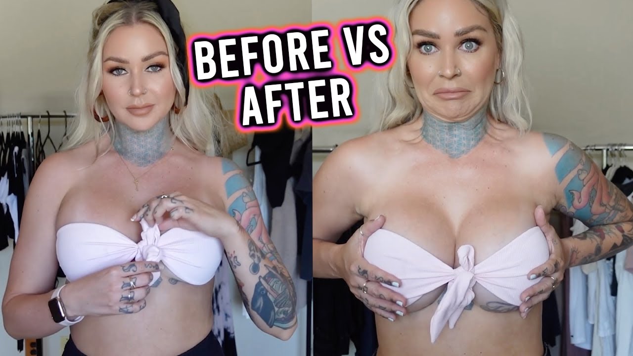 Comparing Bathing Suits BEFORE VS AFTER 2nd Surgery