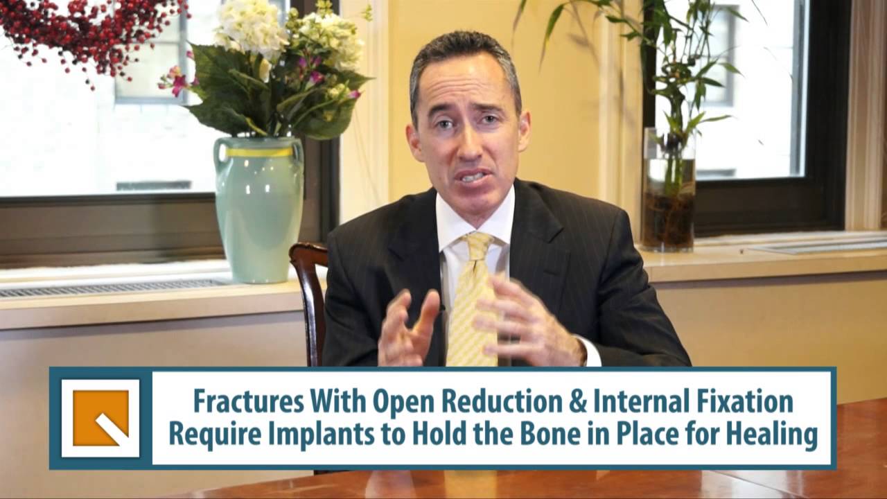 In an Accident & Have Fractured Bone - How Much is Your Case Worth? NY Attorney Dallin Fuchs
