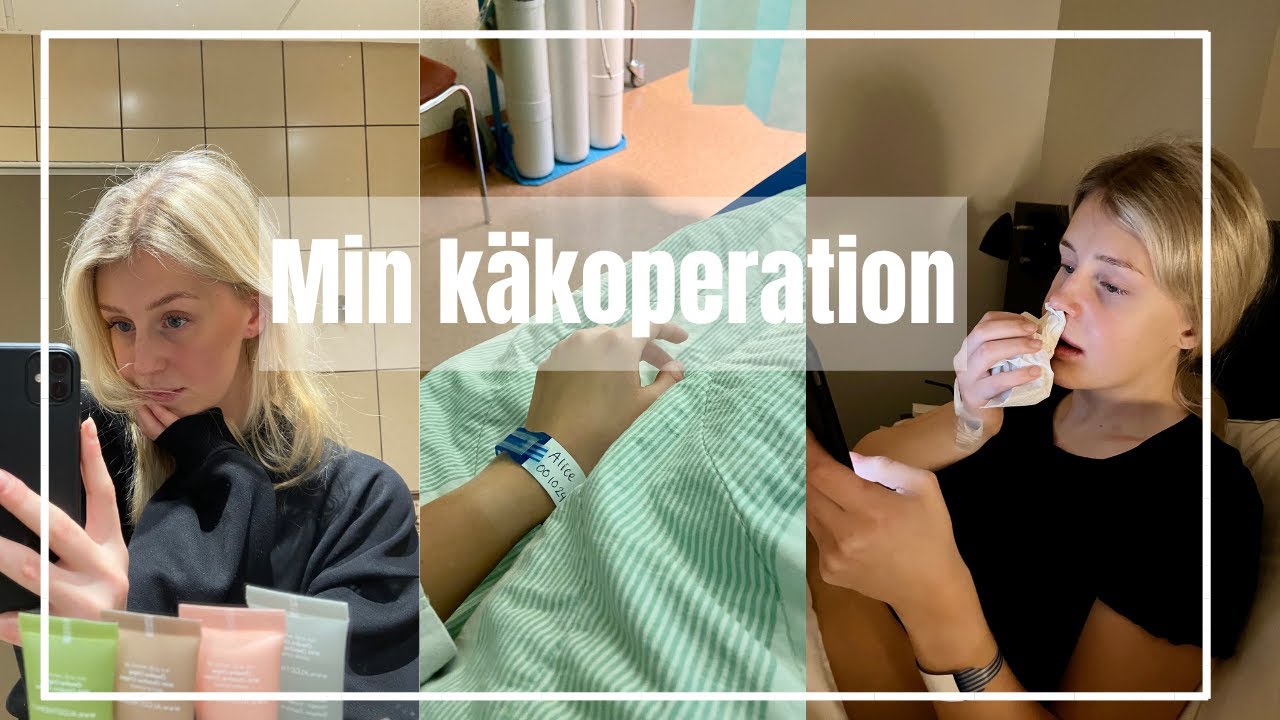 Del 3. Min käkoperation
