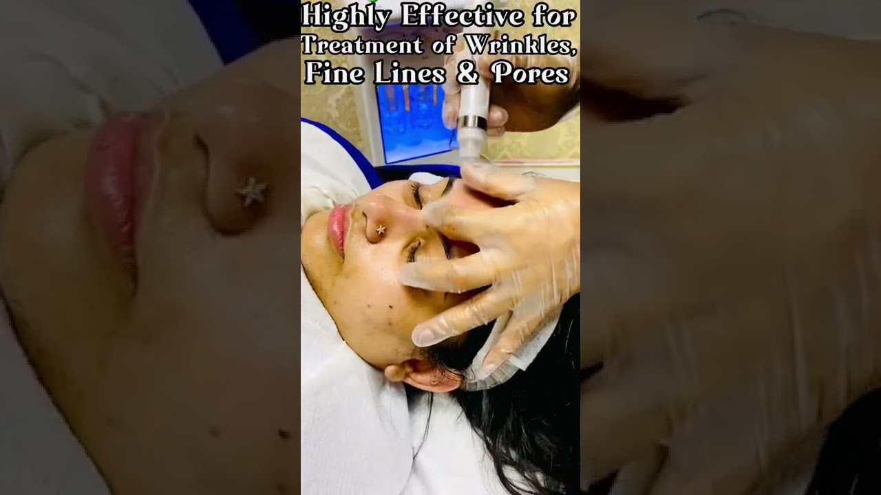 Hydra Facial treatment.  Lotus Ladies Saloon.  Al Nabba.    Near Mubarak Center.   06-5615929