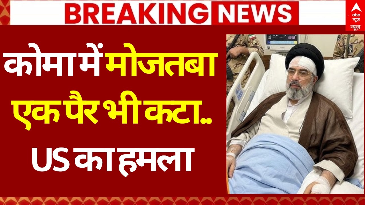 Mojtaba Khamenei in Coma? News LIVE: कोमा में मोजतबा, एक पैर भी कटा..US का हमला | America | Trump