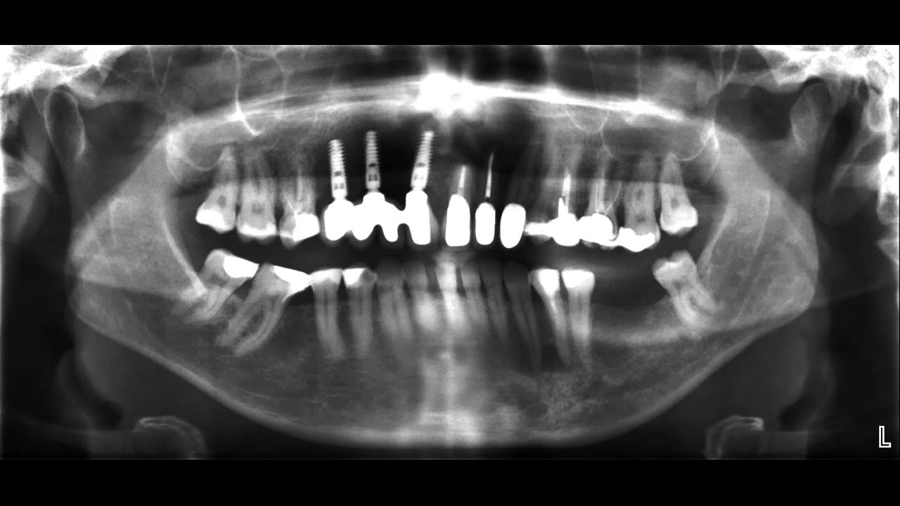 für Zahnärzte: das OPTG Röntgen