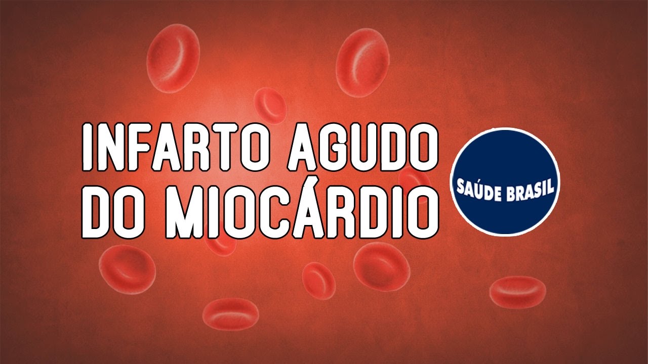 INFARTO AGUDO DO MIOCÁRDIO | SÉRIE SAÚDE BRASIL