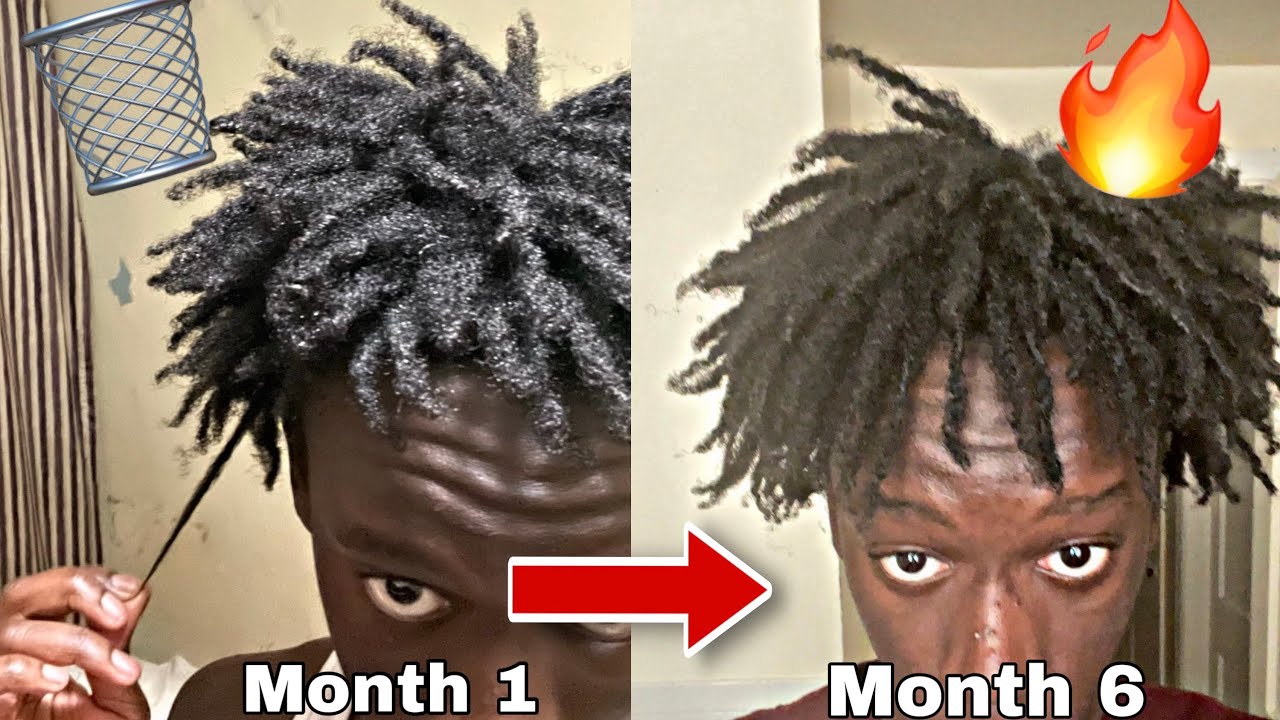 My Freeform Dread Journey Explained *INSANE GROWTH*