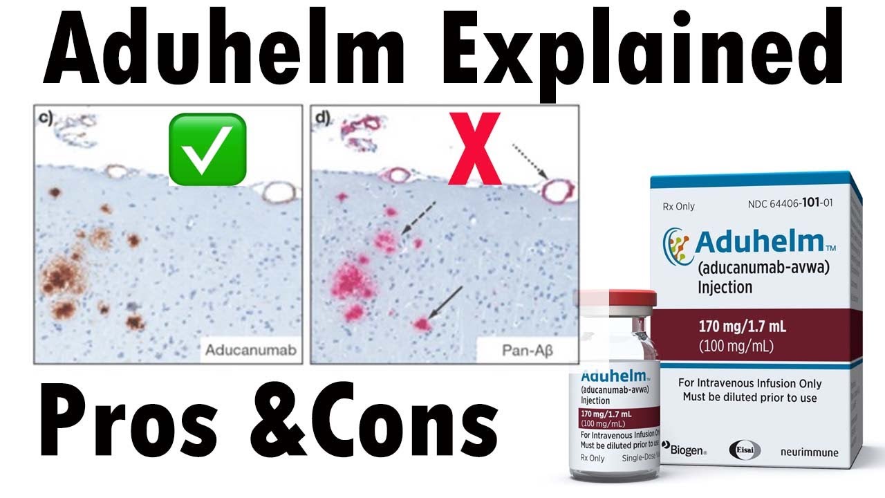 Alzheimer's drug Aduhelm explained | Aducanumab and Alzheimer's disease #Aduhelm
