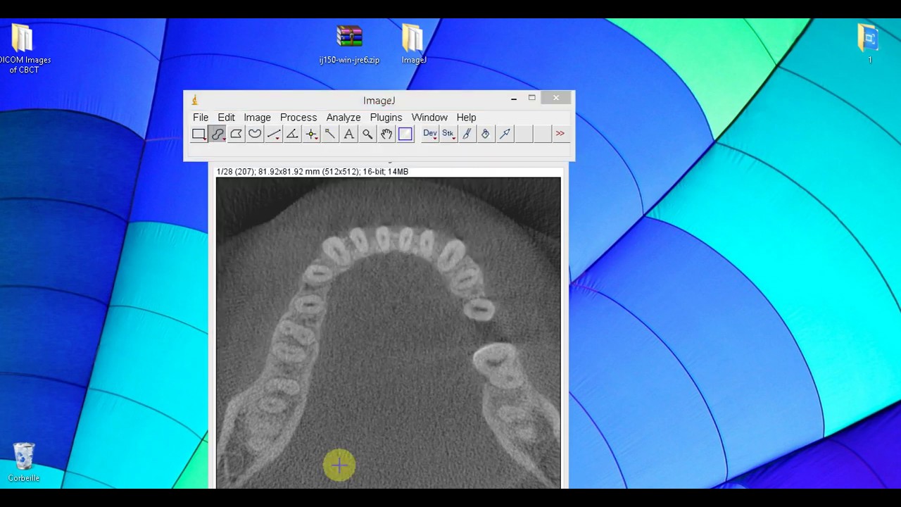 ImageJ & Volume measurement using Manager ROI
