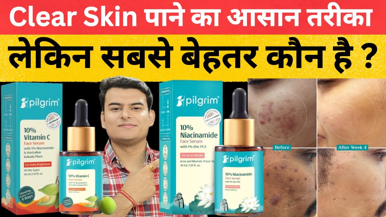 pilgrim vitamin c serum | pilgrim serum review | pilgrim niacinamide serum review