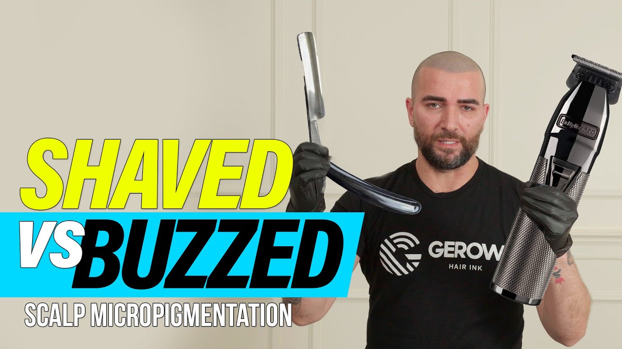 SHAVED VS BUZZED SCALP MICROPIGMENTATION
